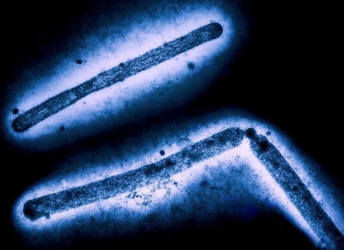 Bird flu case reported in Los Angeles after state officials declare emergency