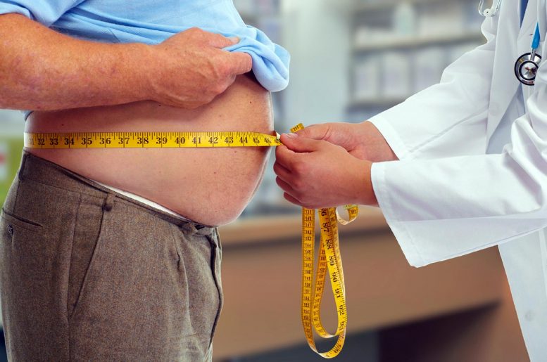A New Way To Treat Obesity? Scientists Discover Brain Molecules That Control Food Cravings