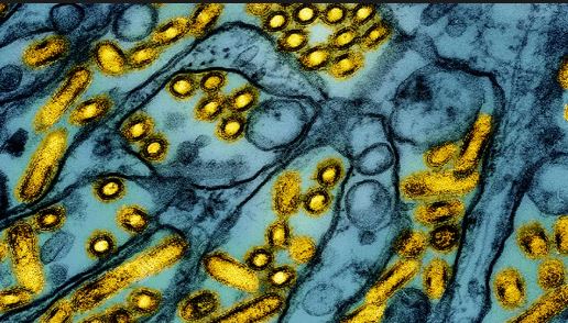 Human bird flu case confirmed in Los Angeles County